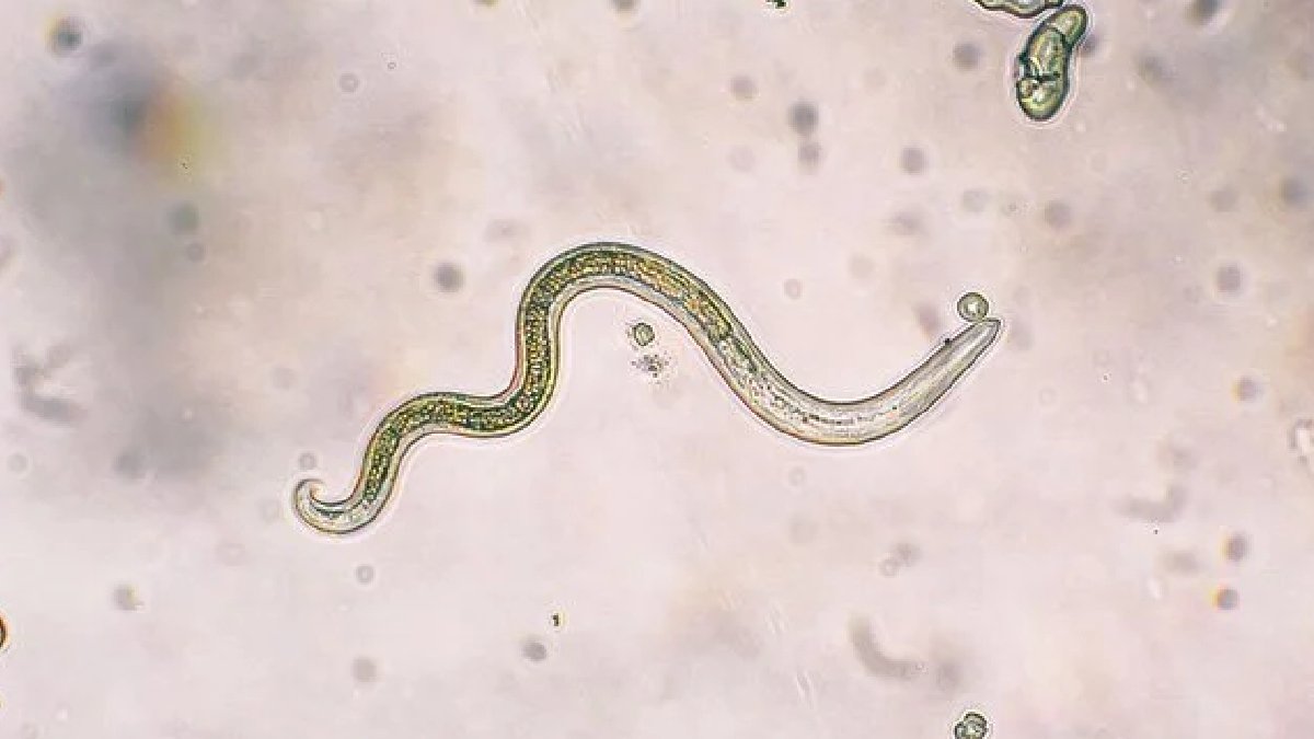 Parazitin şifreleri çözüldü: Acıyı hissettirmeden vücuda giriyor