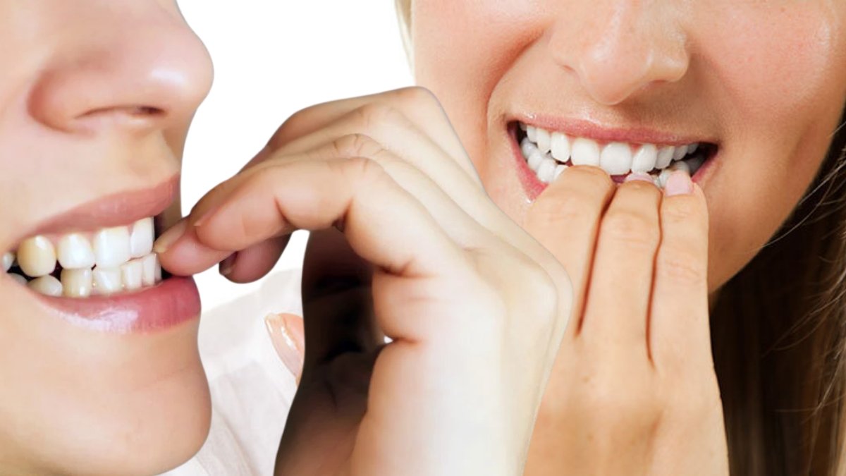 Sessiz tehlike: Tırnak yeme alışkanlığı dişlerinizi çürütüyor! Her 3 gençten biri risk altında