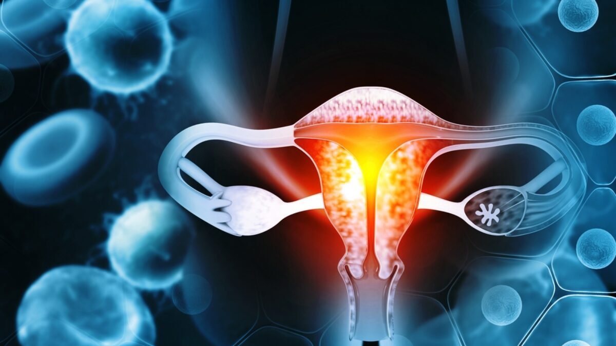 Türkiye'de kadınlarda en sık görülen kanser: Doktor açıkladı, bu 5 gizli belirtiyi asla görmezden gelmeyin!