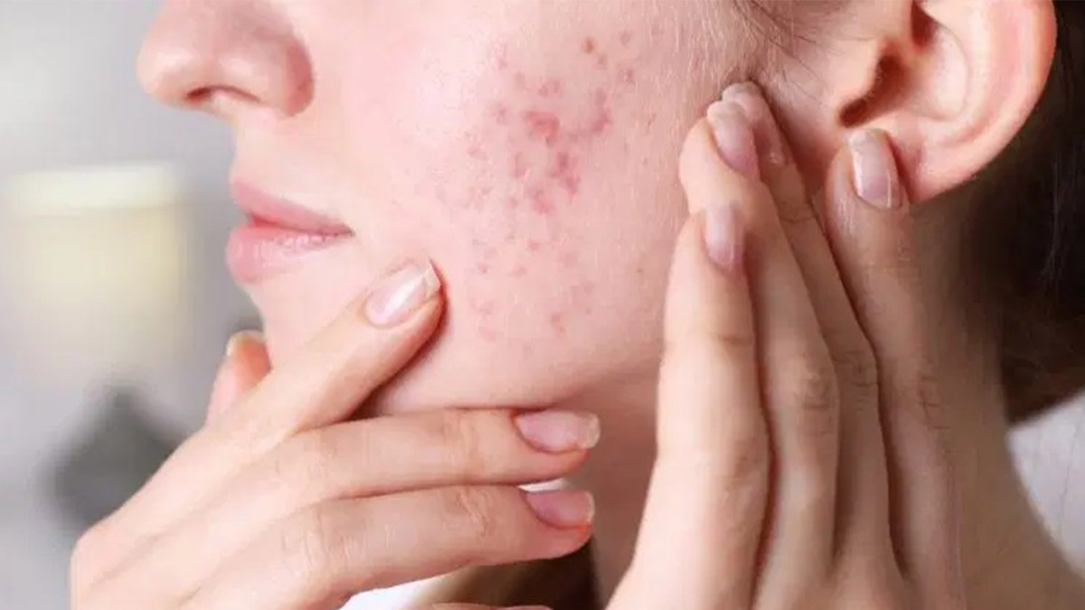 İnternette 'mucize' diye satılan ürünler cilt sorunlarına neden oluyor