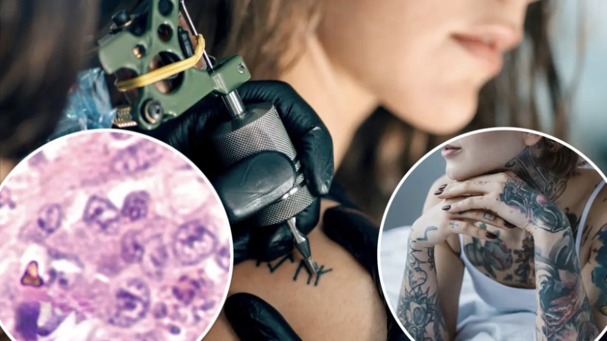 Büyük dövme yaptıranlar dikkat! Prof. Dr. Sönmez bilimsel araştırmanın sonuçlarını duyurdu