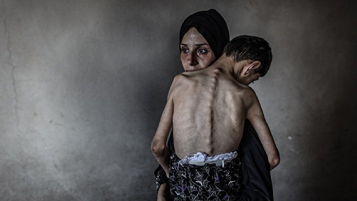 Gazze’de açlıktan son bir ayda 185 kişi can verdi
