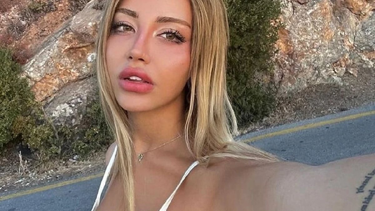 Bir doktor ünlü fenomen Mika Raun’un estetiklerini saydı