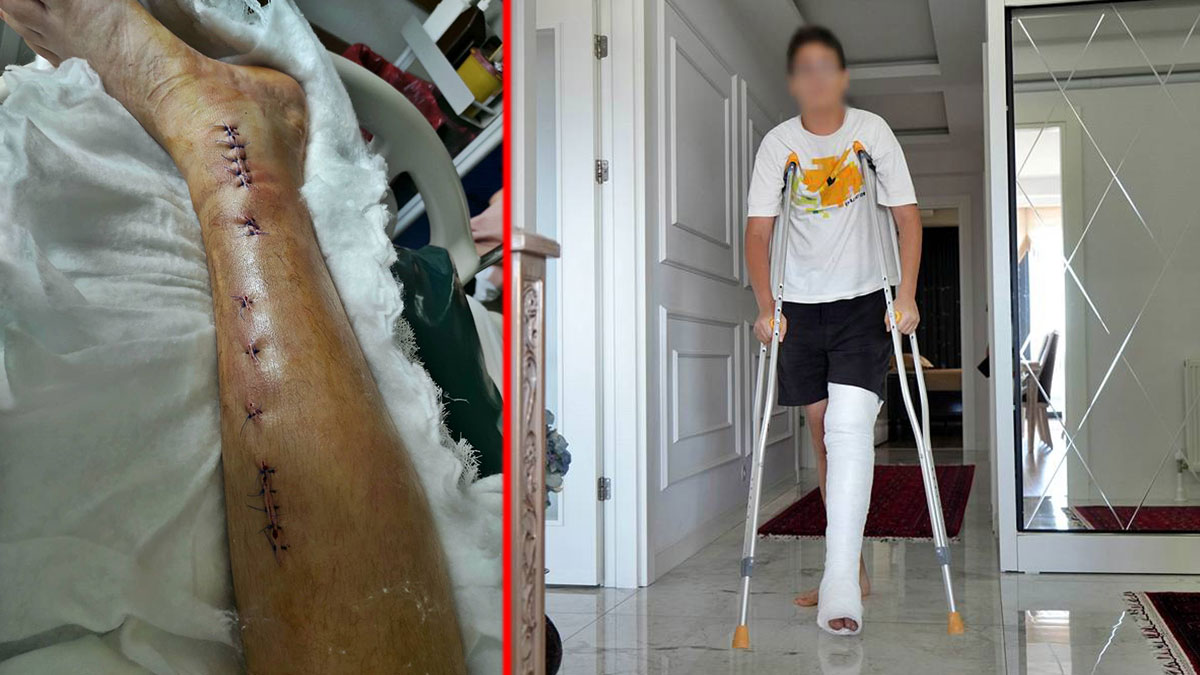 Okul yönetimi skandalı: Akran zorbalığına 'şaka' dediler!