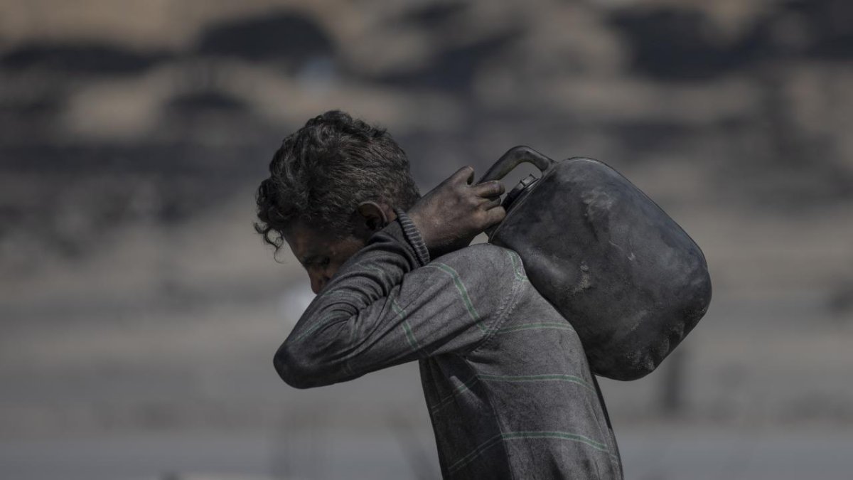 BM: Gazze'de insani durum feci boyutta