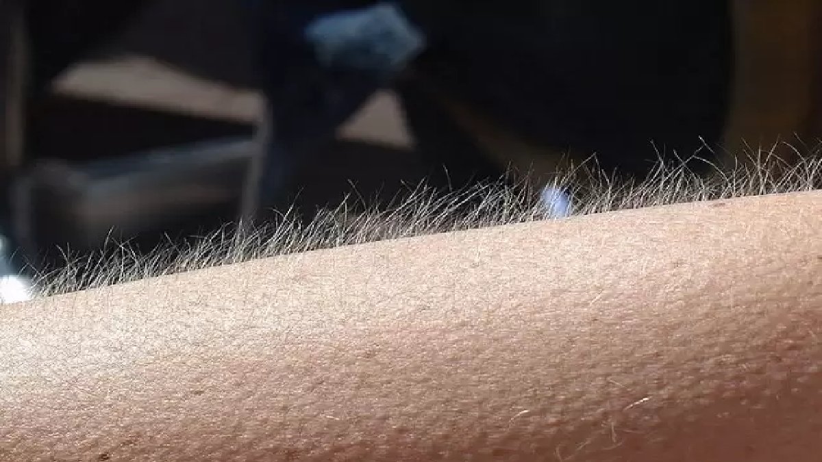 Tüyler neden diken diken olur? Gerçekler sizi de şaşırtacak! Bakın asıl sebebi neymiş…