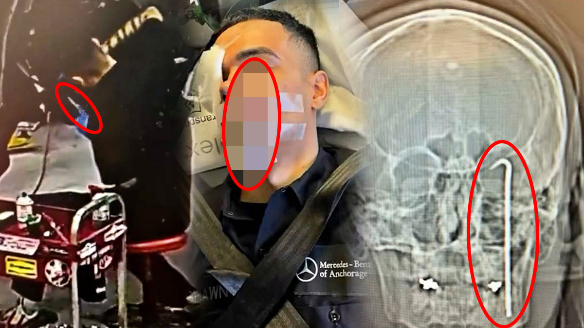 Tornavida gözünden girip kafasına saplandı! İş kazası kamerada