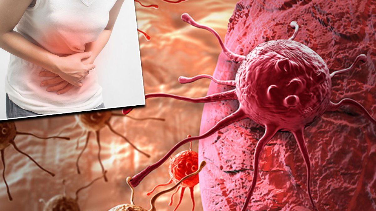 Her iki kişiden birinde görülüyor: Helicobacter pylori bakteri kanser riskini arttırabilir