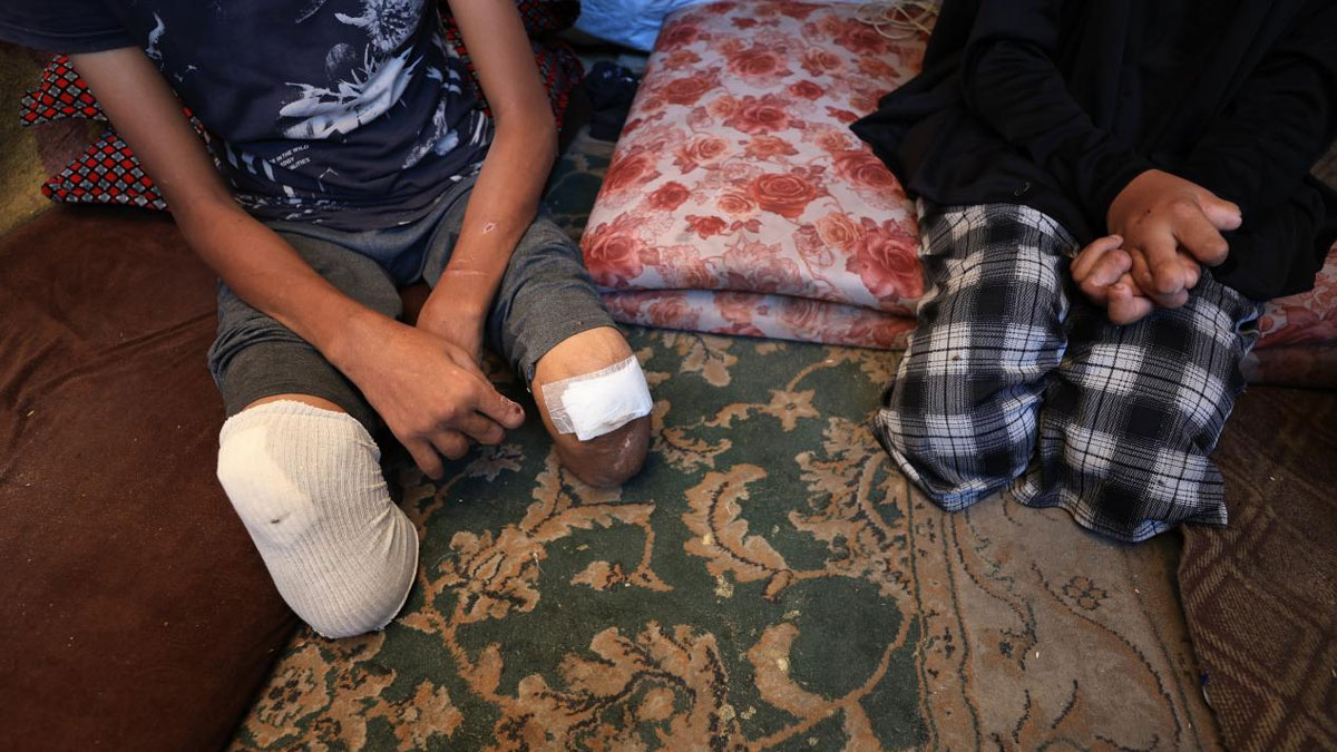 UNRWA: 7 Ekim'den bu yana Gazze'de 4 bin çocuk ampute edildi