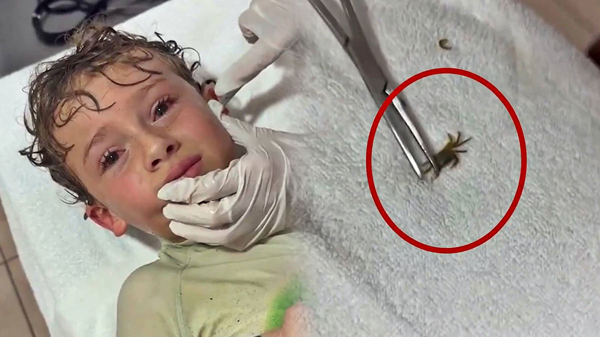 Akla ziyan olay! Kulağından yengeç çıktı