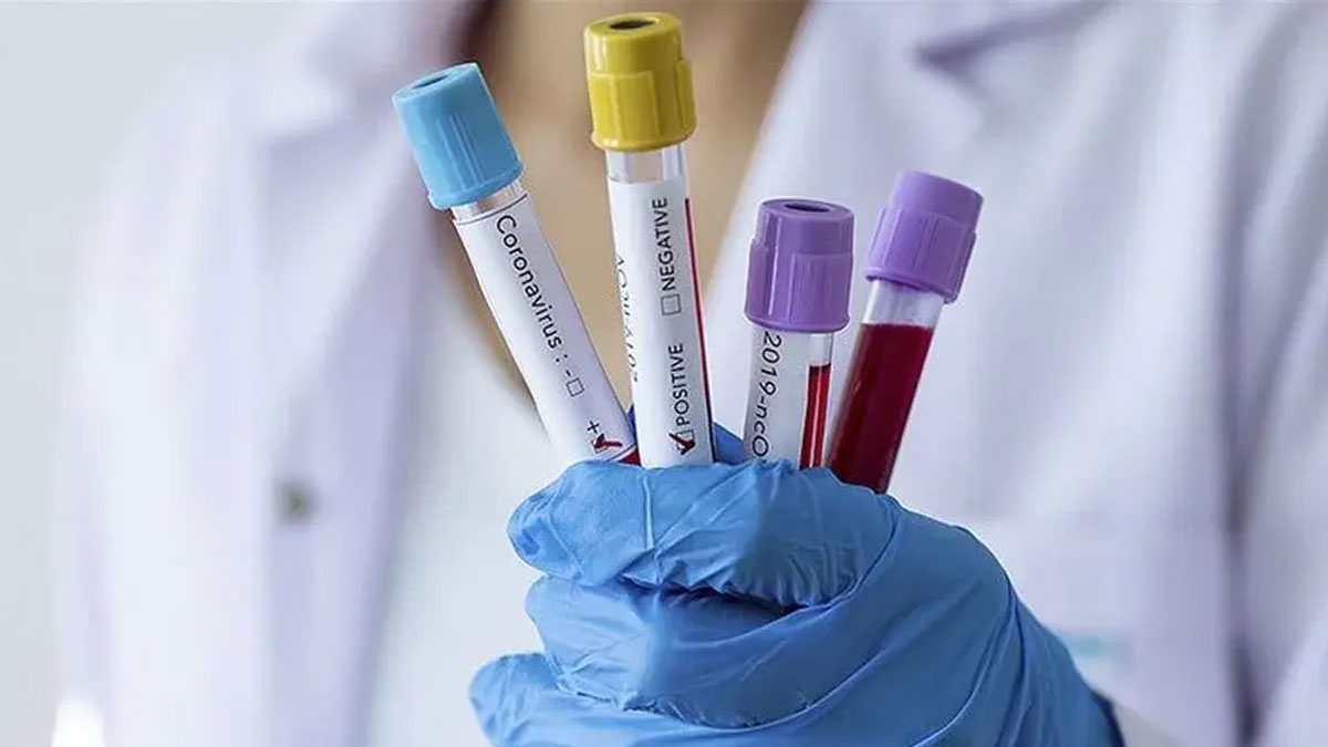 Uzmanlar uyardı: Kovid-19 vakaları yeniden artıyor