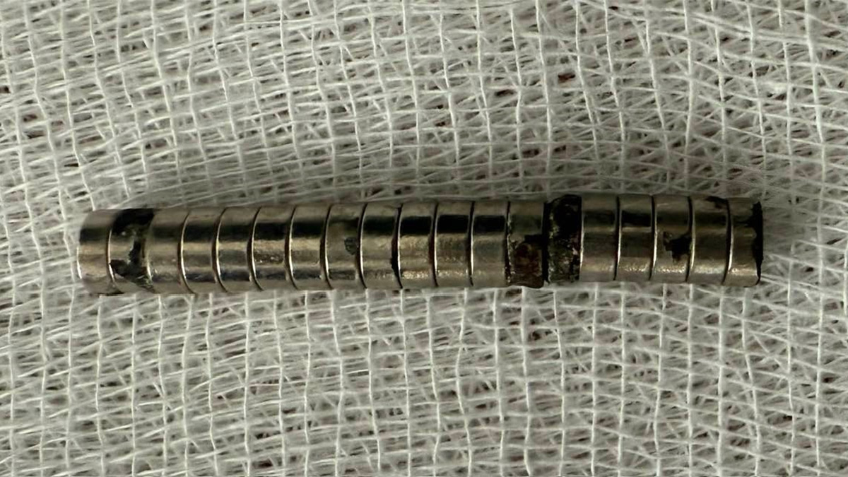 3 yaşındaki çocuğun boğazından 19 mıknatıs çıkarıldı