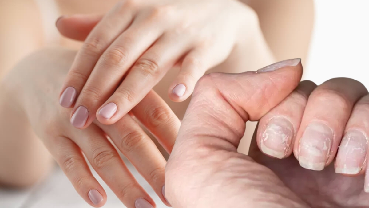 Tırnak kırılmalarına, soyulan etlere son! Doğal yöntemlerle bu dertten kurtulabilirsiniz: İşte o doğal formüller