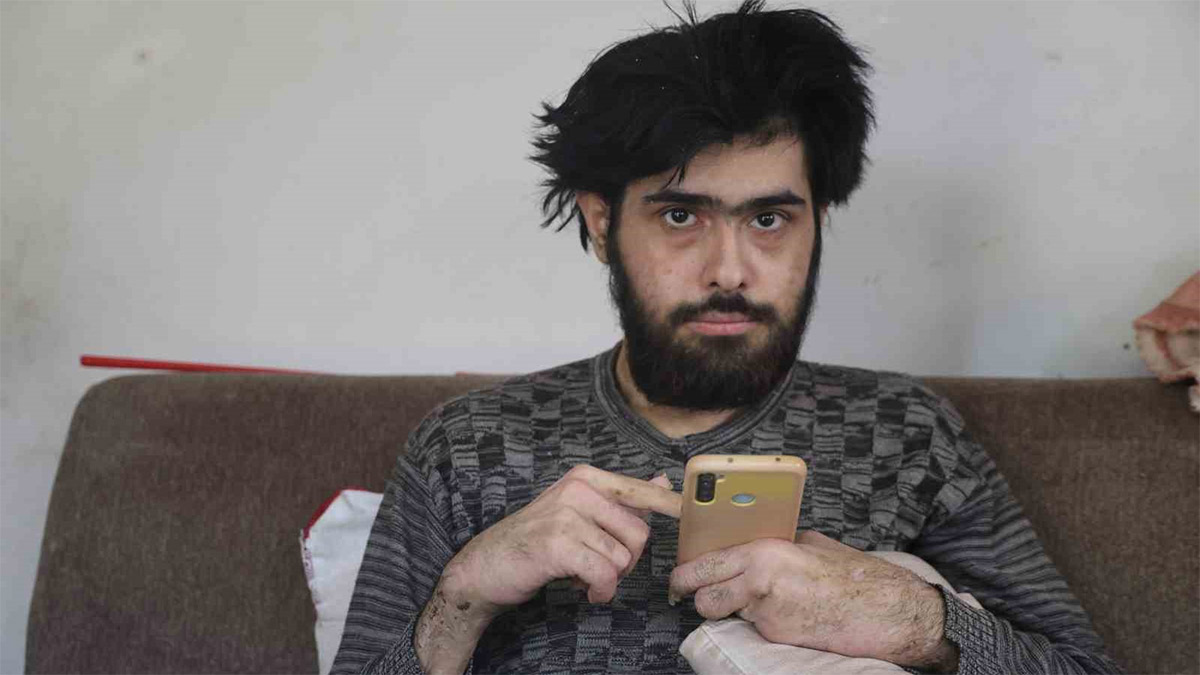 23 yaşındaki genç depremden sonra kendini eve kapattı! 3 yıldır banyo yapmıyor, tırnaklarını kesmiyor