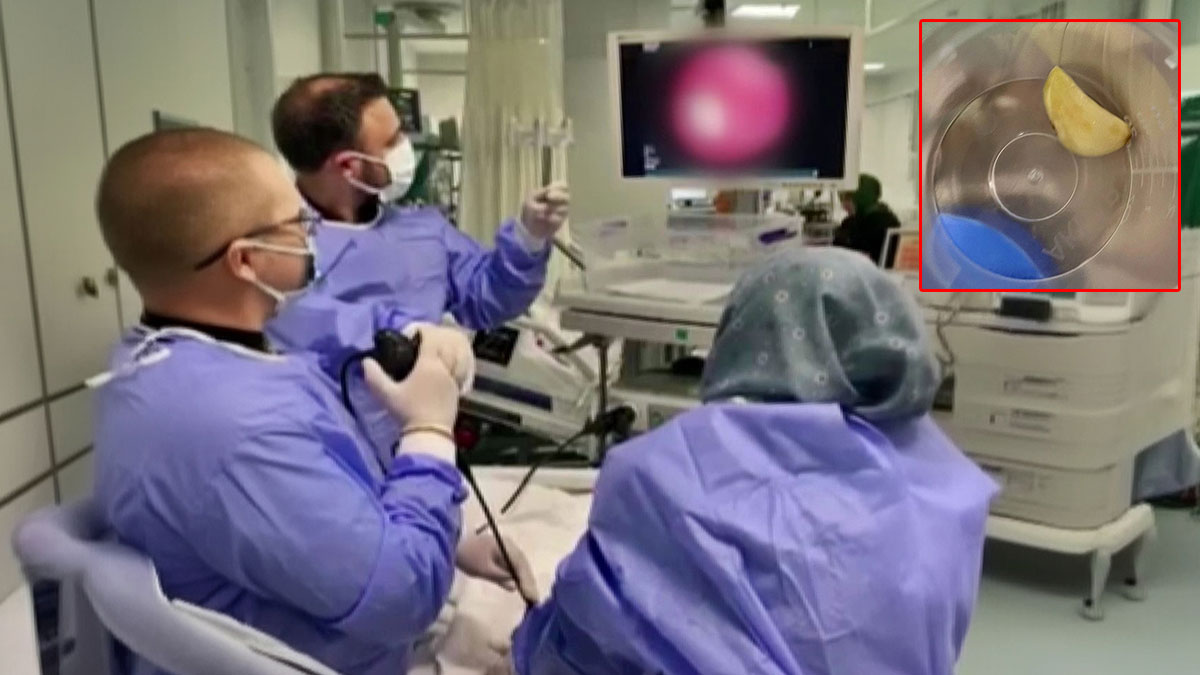 Akciğerindeki tıkanıklığın nedeni sarımsak çıktı!