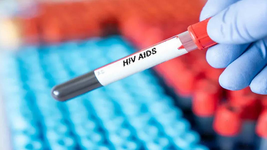 AIDS tedavisinde yeni umut: Virüsü hücreye girmeden durduran antikor bulundu