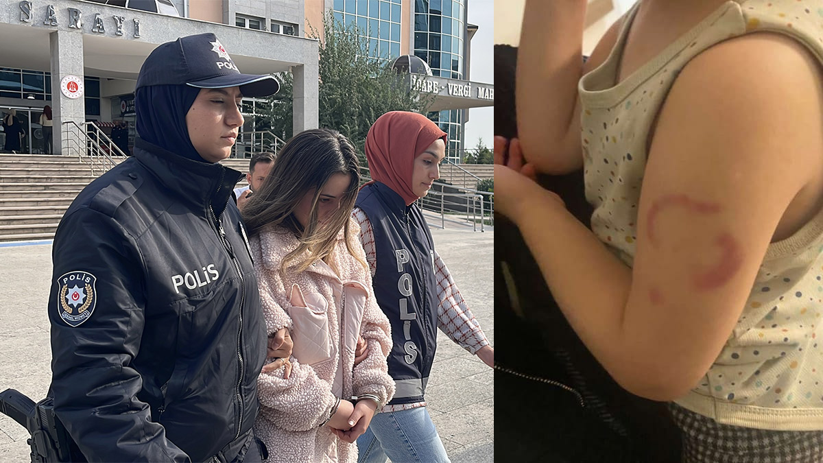 'Öperken oldu' demişti: Kreşte 3 yaşındaki çocuğu ısıran öğretmen tutuklandı