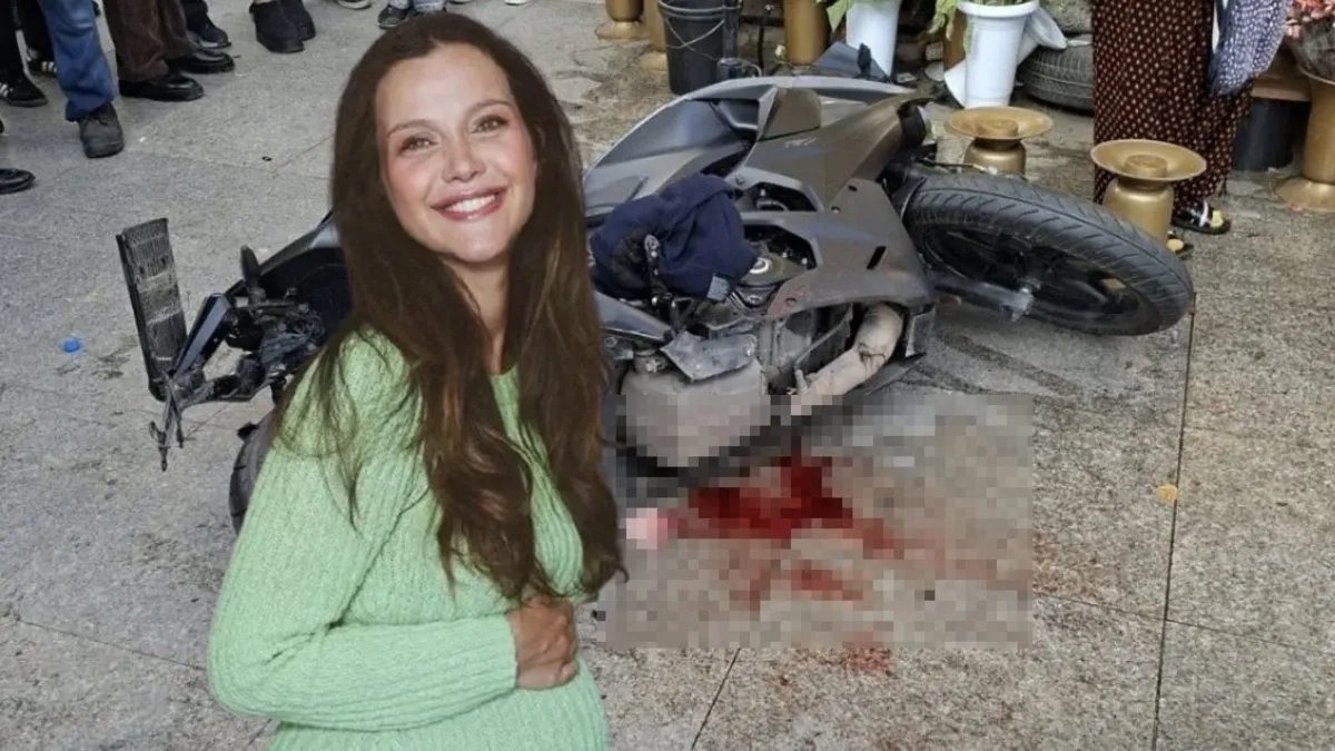 Güzel oyuncunun başına gelen pişmiş tavuğun başına gelmez! İrem Helvacıoğlu ikinci kez kaza yaşadı