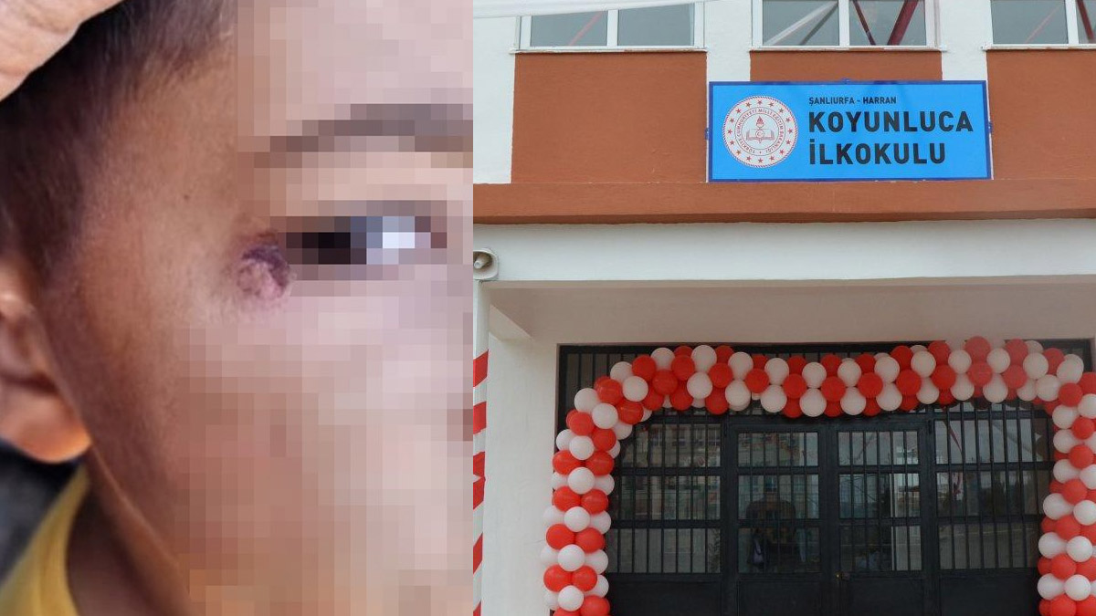 Okulda korkunç olay! Temizlik görevlisi çocuğun yüzünde sigara söndürdü