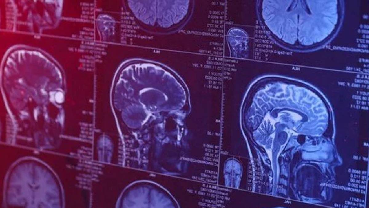 Uzmanlar uyardı: Beyin sağlığını tehdit eden günlük davranışlar