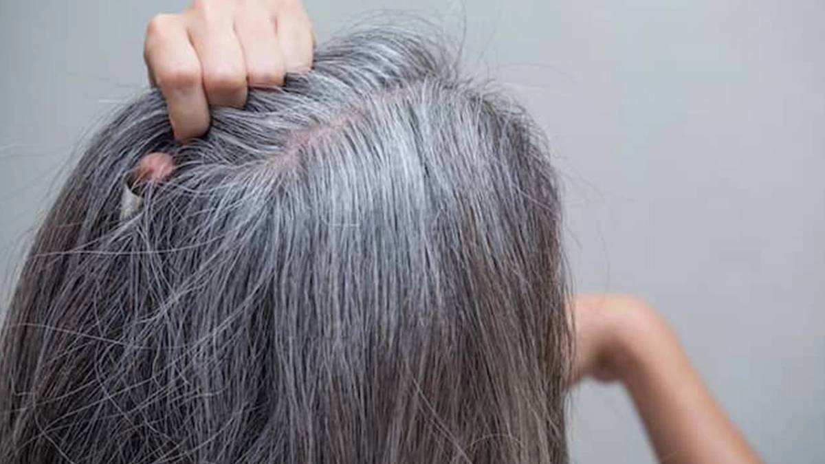 Bilim insanları açıkladı: Saç beyazlaması kansere karşı doğal kalkan