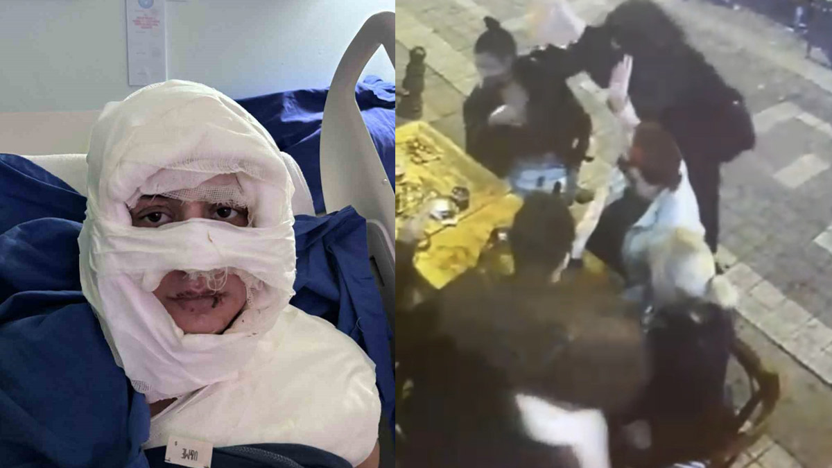 Kadıköy'de dehşet! Genç kadının üzerine yanıcı madde döküp ateşe verdi