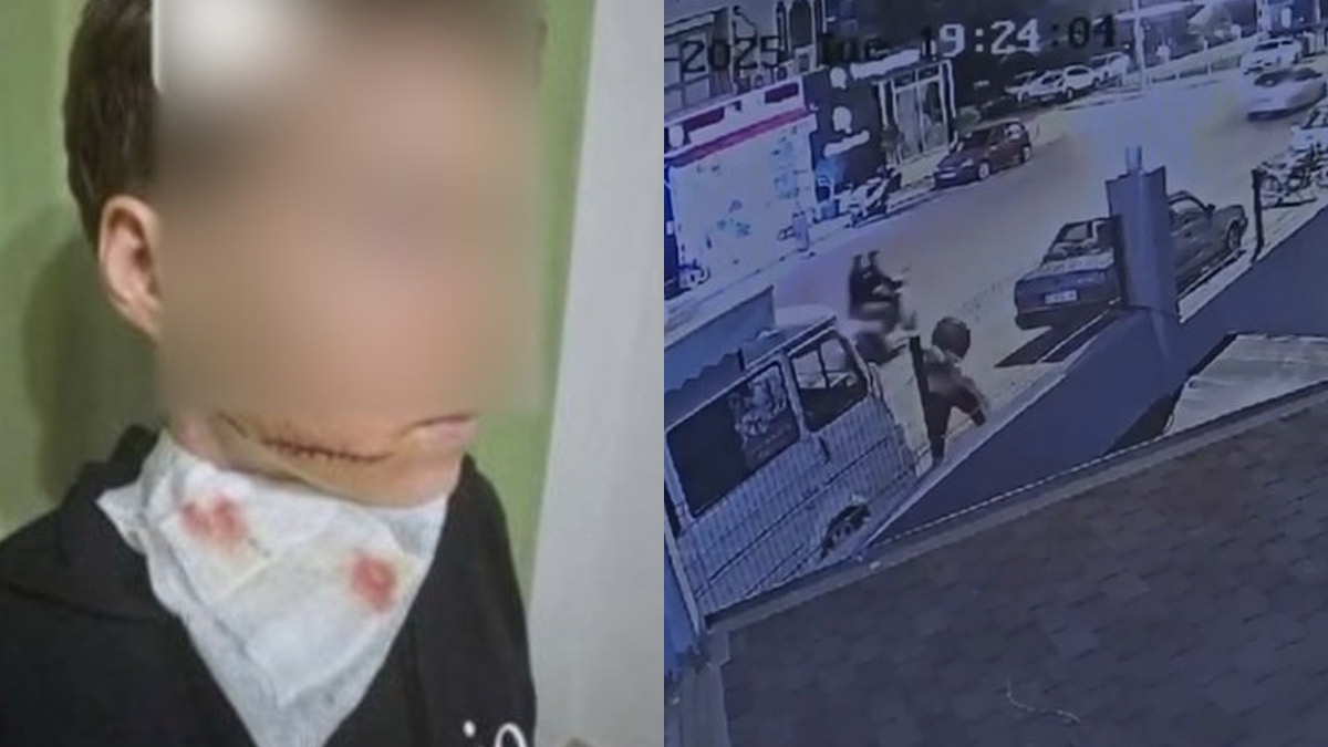 Antalya'da sokak ortasında dehşet! Yolda yürüyen kadını önce yumrukladı sonra yüzüne kesici cisimle saldırdı