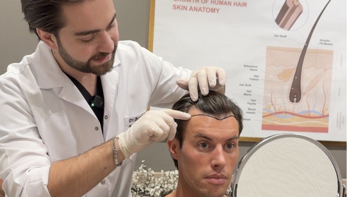 Saçlar neden dökülür?