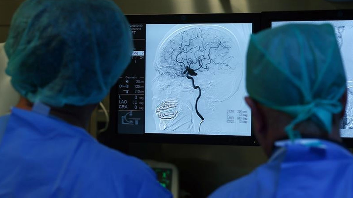 Bilim insanları beynin beş farklı yaşam evresinden geçtiğini açıkladı: Kritik dönüm noktaları 9, 32, 66 ve 83 yaş