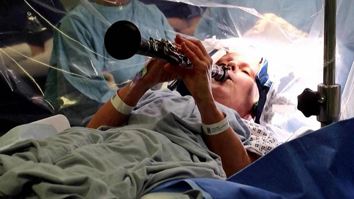 Beyin ameliyatı olurken klarnet çaldı! Meğer nedeni tedaviye yanıt verdiğinin işaretiymiş