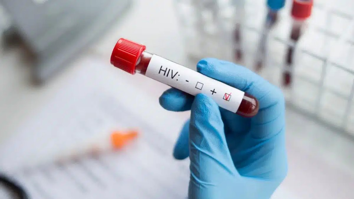 HIV vakaları 10 yılda 12 kat arttı: Uzmanlar 'sessiz pandemi' uyarısı yaptı