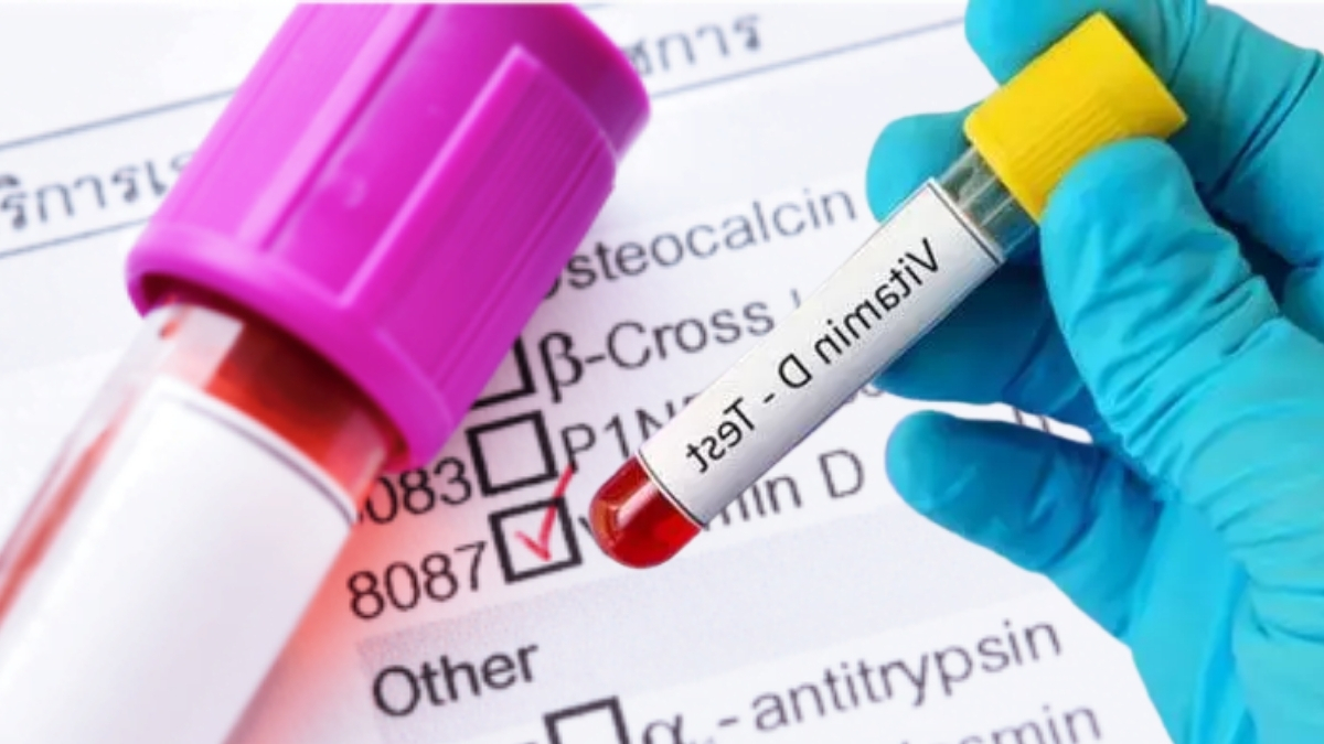 Yaşam kalitesini düşürüyor, hücresel yaşlanmayı hızlandırıyor! Bu vitamini hemen kontrol ettirin: Eksikliği yaşlandırıyor