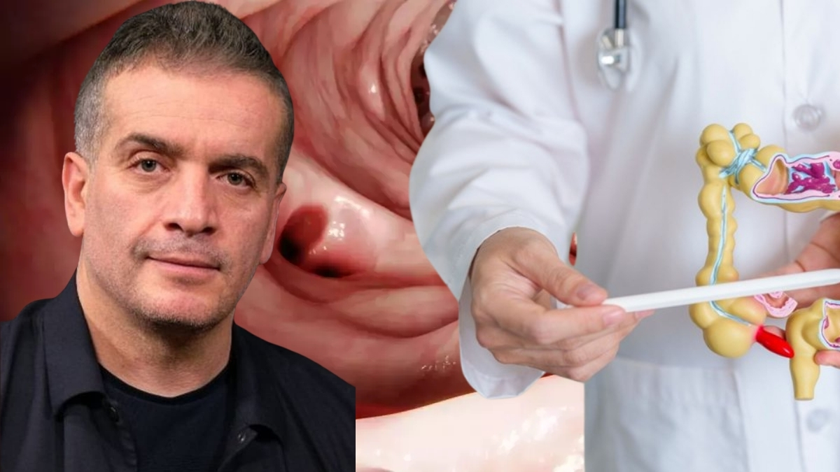 Murat Cemcir’i yoğun bakımlık etti! 50 yaş üstünü tehdit ediyor: Diverikül kanaması nedir, neden olur?