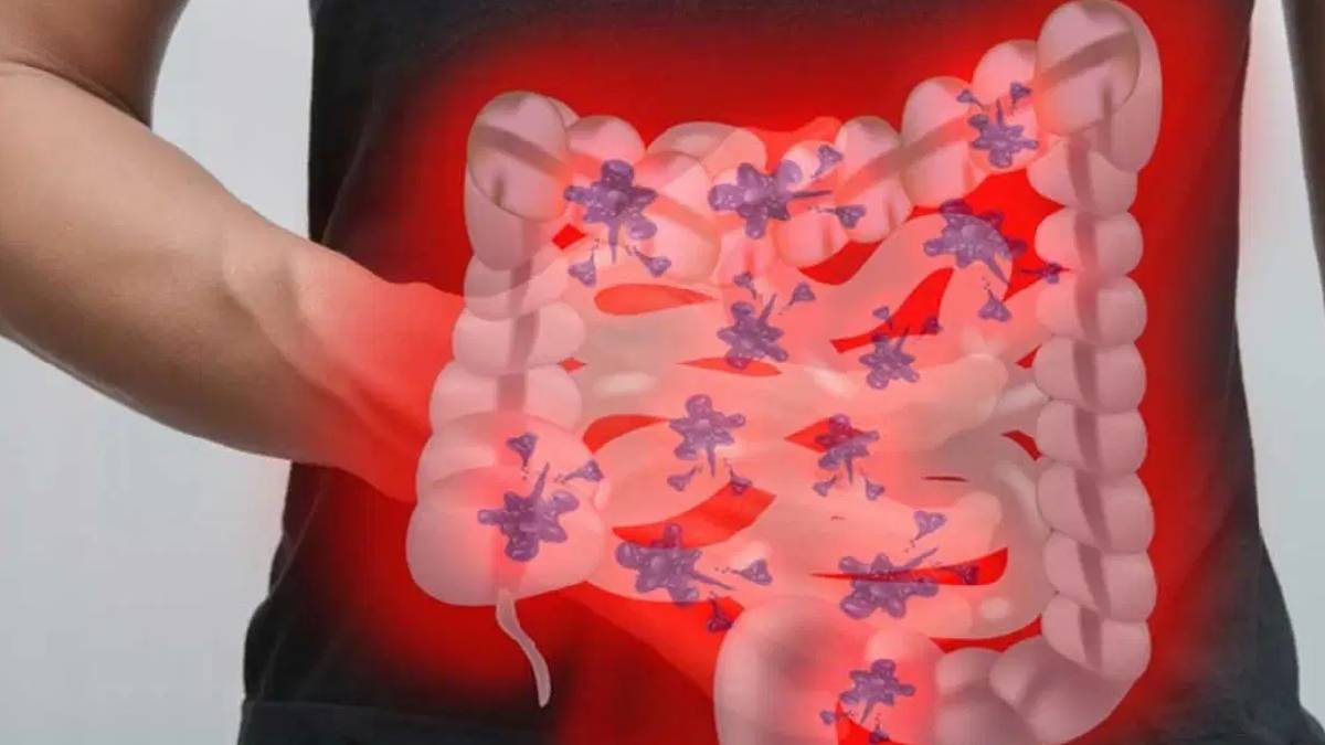 Uzmanlardan uzun ömür uyarısı: Bağırsak sağlığı yaşam süresini belirliyor