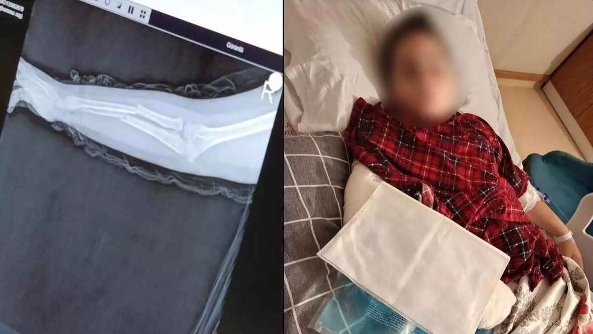 Okulda akran zorbalığı: 9 yaşındaki çocuk arkadaşının kolunu kırdı