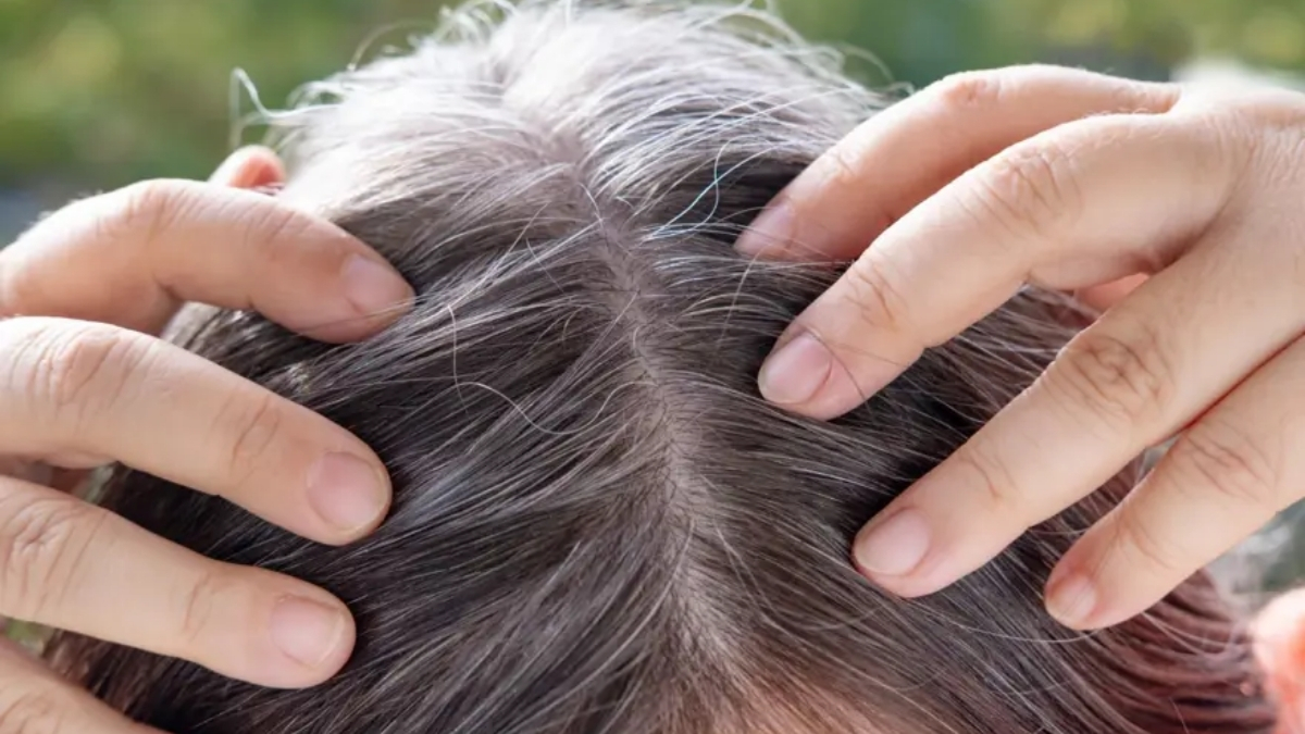 Yaşlılık belirtisi olarak görülüyor lakin hastalıklardan koruyor! Risk ortaya çıkınca saçlar beyazlıyor