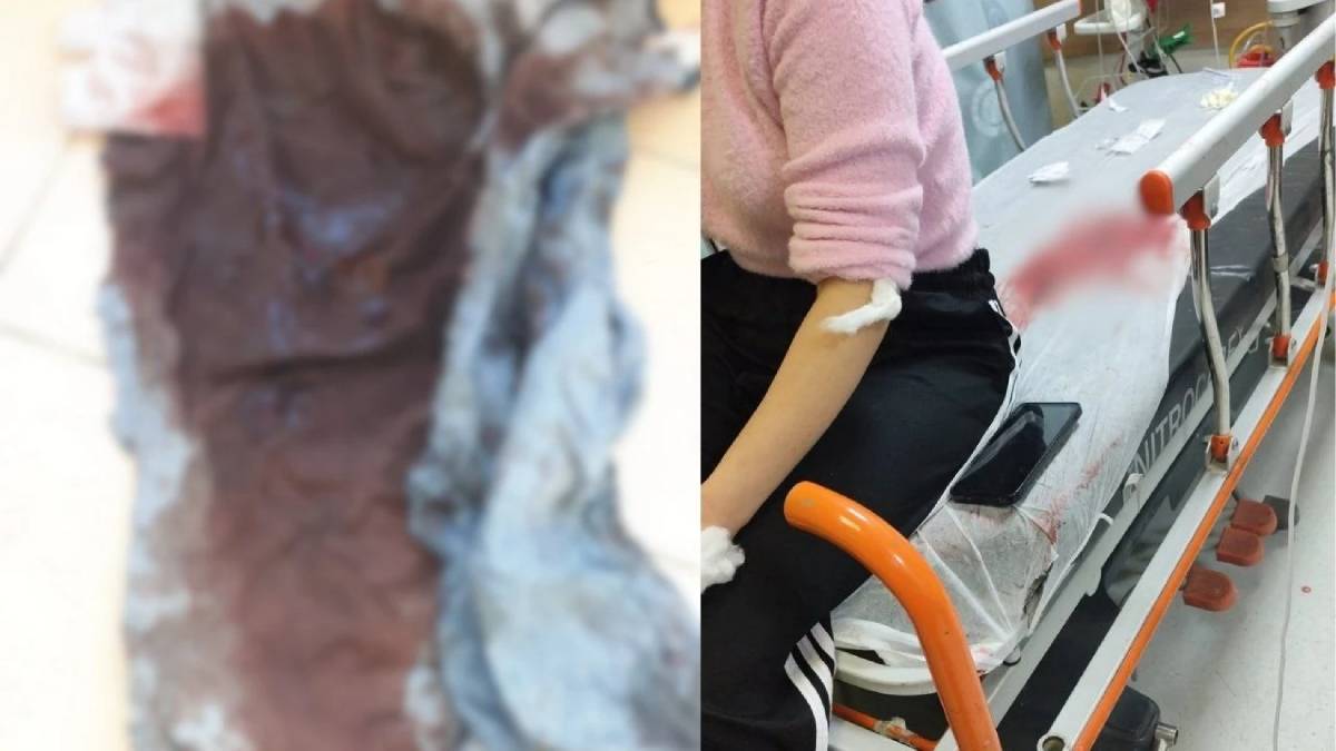 Gelin-görümce kavgası bu sefer kanla bitti! Akaryakıt istasyonunda gördü, eski yengesini bıçakladı