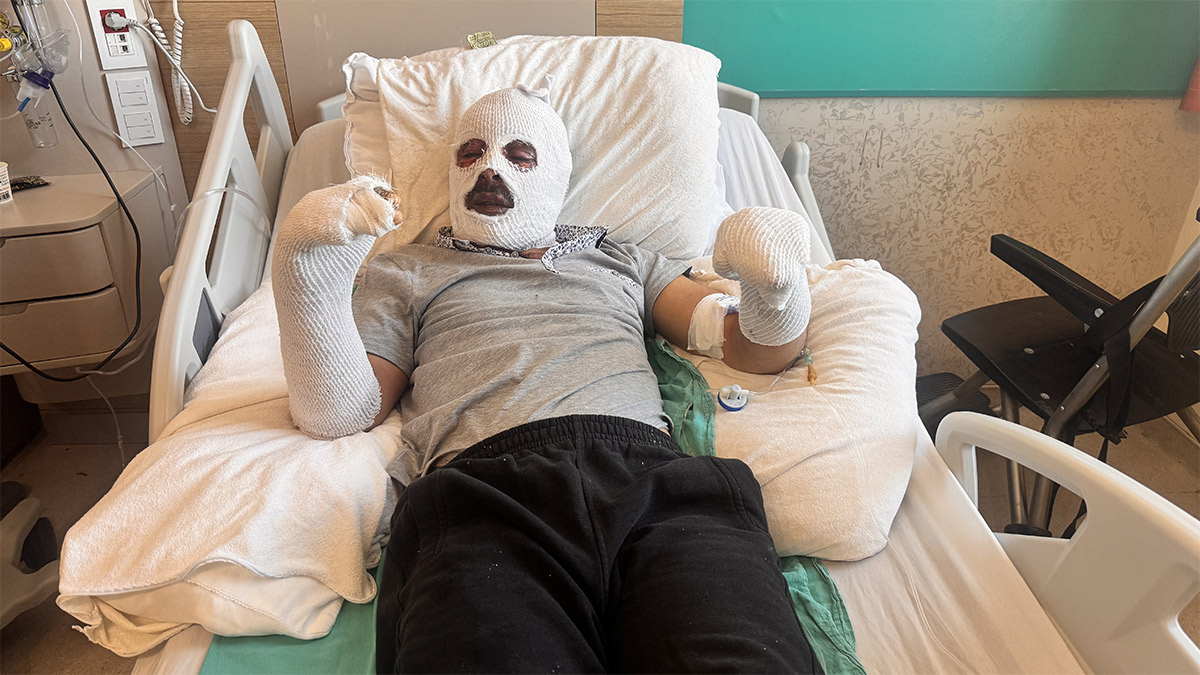 Gaz kaçağını fark edemedi, tüp patladı! Çay demlemek isterken vücudunun yüzde 26’sı yandı