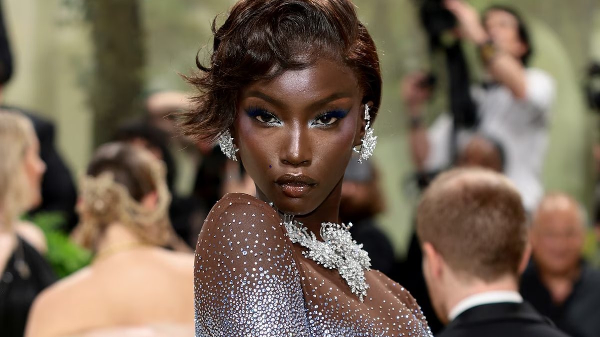 Ünlü model Anok Yai, mücadele ettiği hastalığını açıkladı