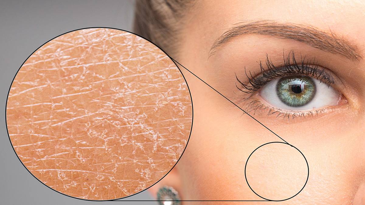 Pul pul dökülmelere son! Mutfağınızdaki 2 malzemeyle bebeksi görünüm!