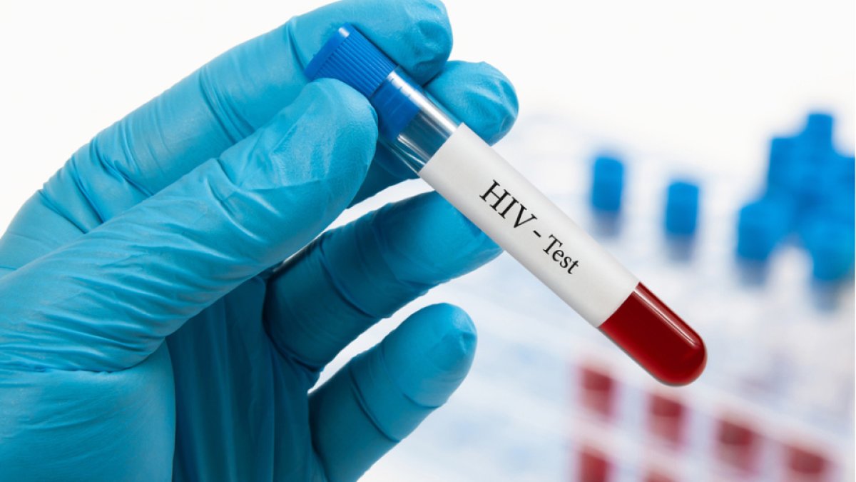 Türkiye’de HIV alarmı: Vaka sayıları dünyanın aksine yükselişte