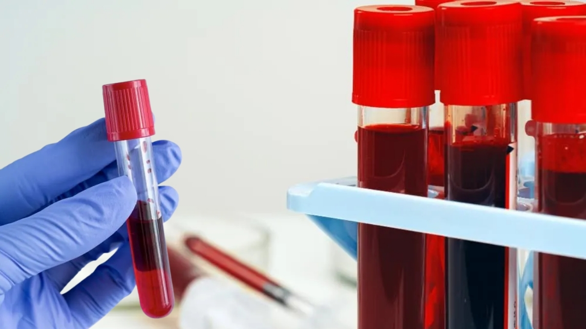 Bilimsel araştırma yapıldı, risk ortaya koyuldu! Hangi kan grubu tehlikeli? İşte hastalığa yatkın kan grupları
