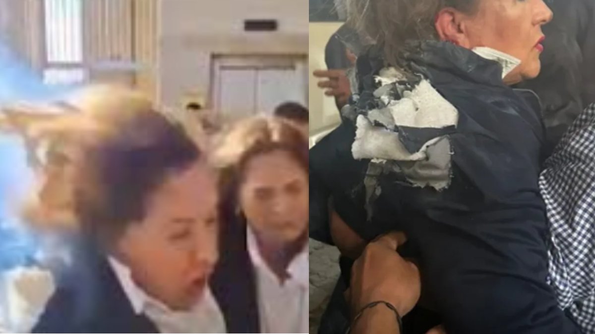 Honduras’ta milletvekiline canlı yayında bombalı saldırı! Ensesine isabet etti