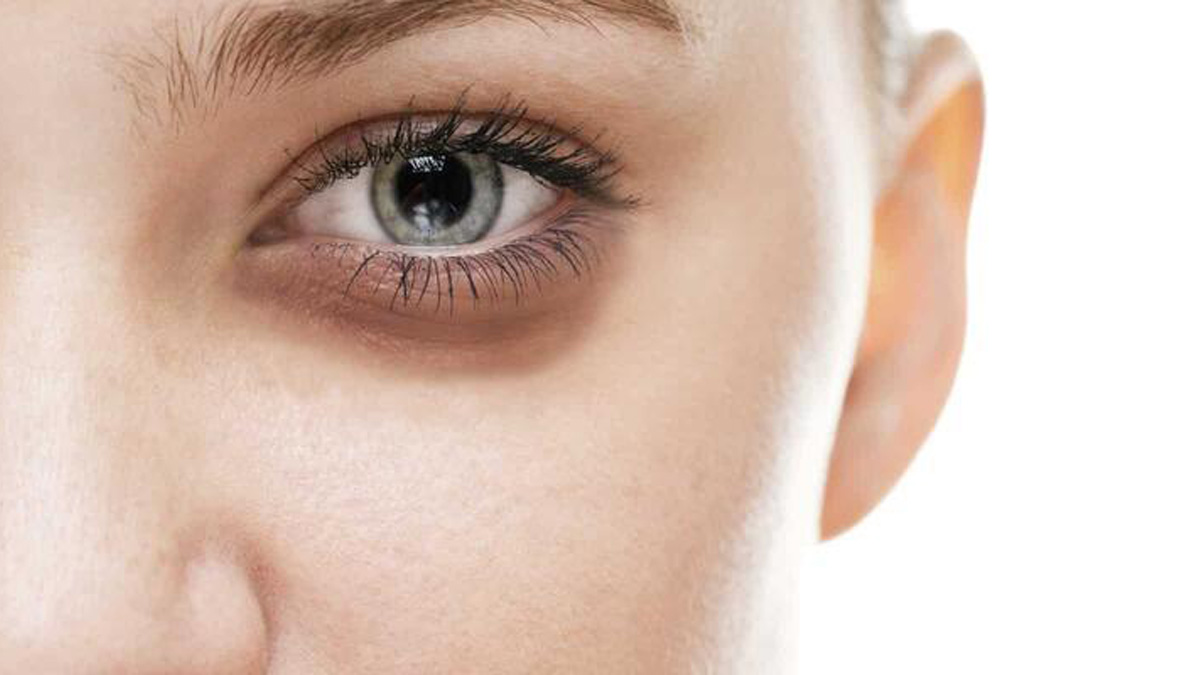 Göz altlarınızda sık sık koyu halkalar mı oluşuyor? O zaman bu 4 alışkanlığınızdan vazgeçmelisiniz