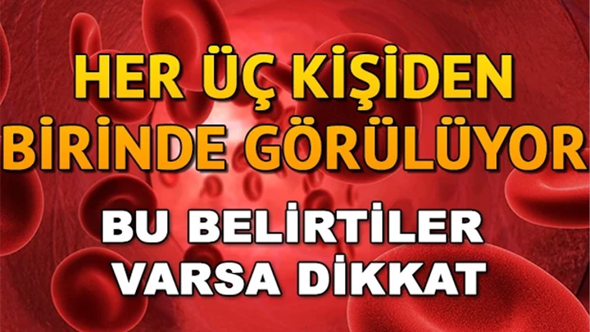 Doktora gitme vaktiniz gelmiş olabilir: Bu 5 şeye karşı iştah duyuyorsanız demir eksikliğiniz olabilir
