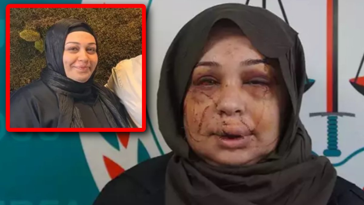 Ankara’da polis eşi tarafından darbedilen kadın isyan etti: "Vicdanı olan herkesten yardım istiyorum"