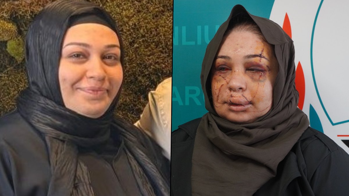 Polis eşi tarafından darbedildiğini öne süren kadın şikâyetçi oldu