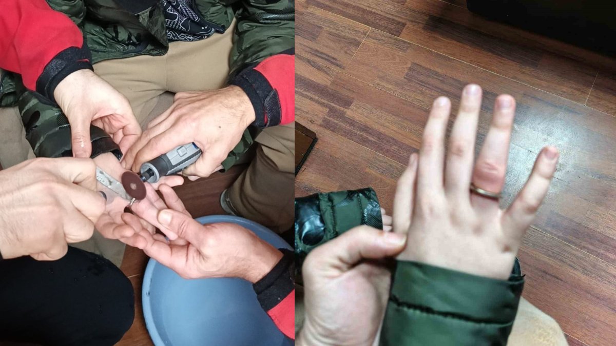 50 kuruşu yüzük yapmak istedi, parmağına sıkıştı: Rize’de itfaiyeden hassas operasyon!