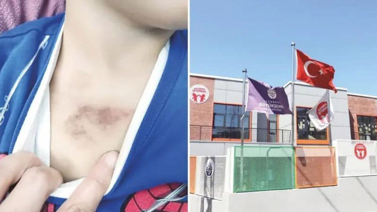 İBB'ye bağlı kreşte 3 yaşındaki çocuğa şiddet soruşturması: 1 tutuklandı