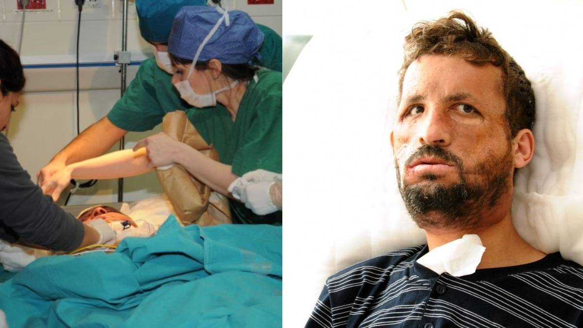 Küçük yaşta ameliyat oldu, yeni bir yüze kavuştu! Türkiye’nin ilk yüz nakli 14 yıl önce ona yapıldı